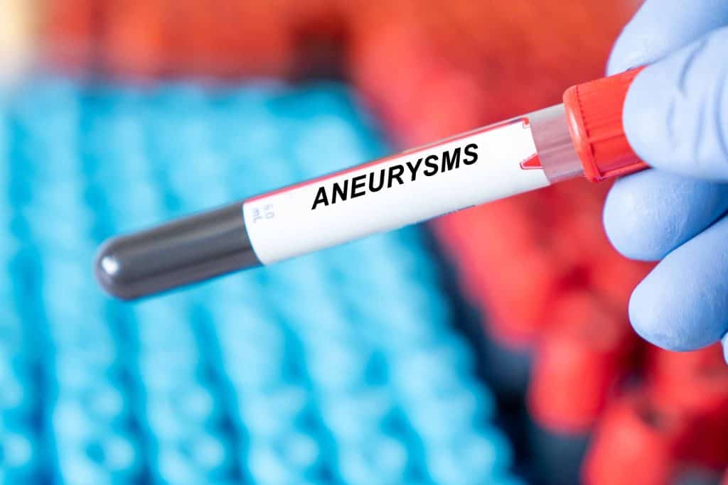 Što je aneurizma