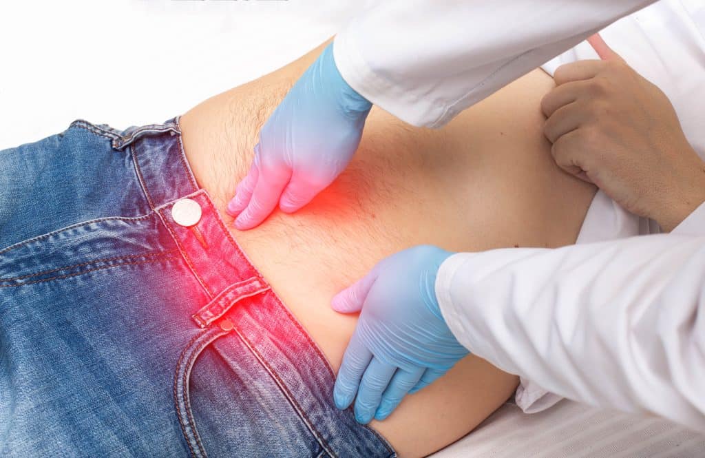 Trbušna kila - uzrok, simptomi, liječenje Trbušna kila - uzrok, simptomi, liječenje