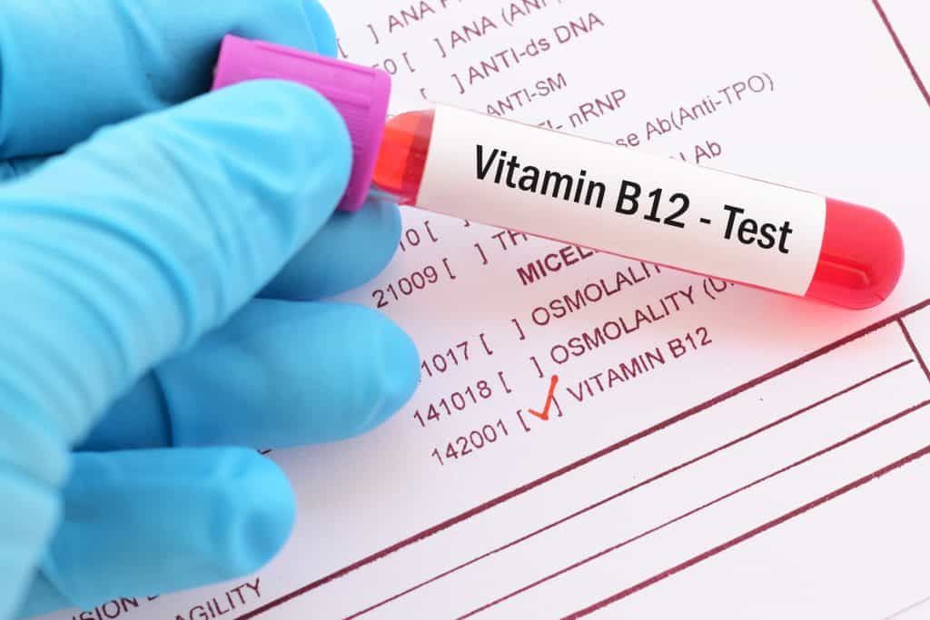 Višak vitamina b12 u krvi - uzrok, simptomi, liječenje