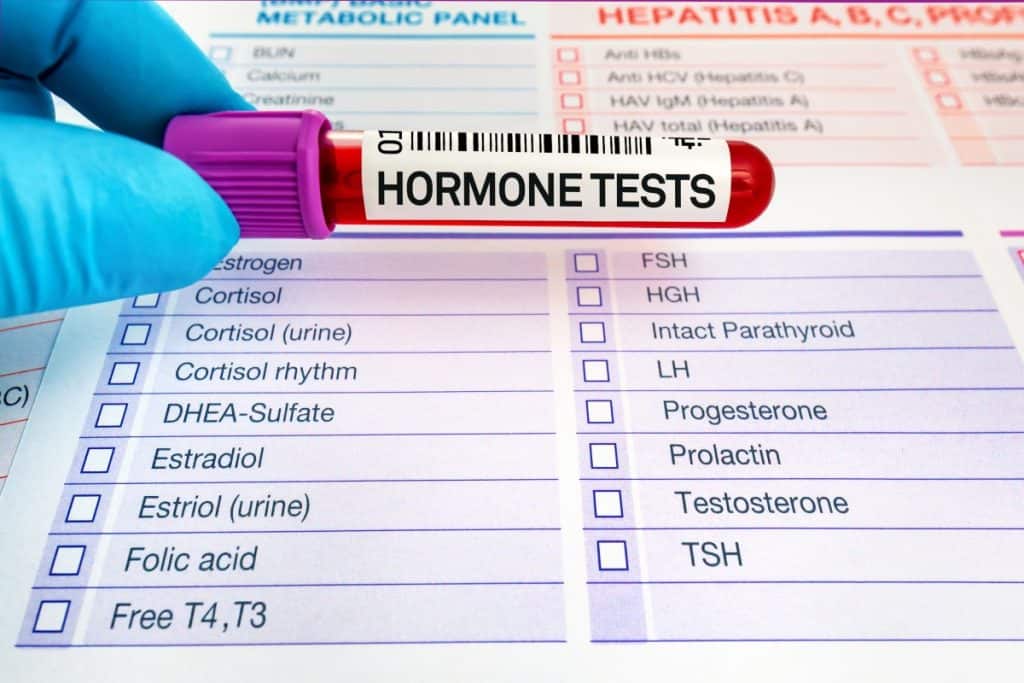 Hormonski test kako se radi