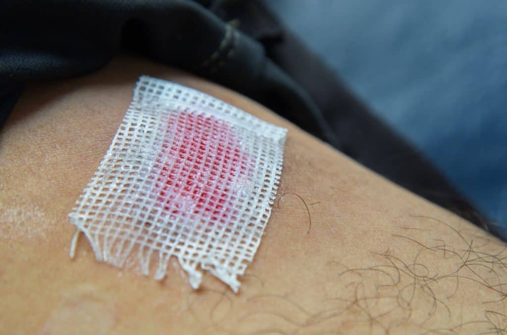 Kako se stavlja vazelinska gaza