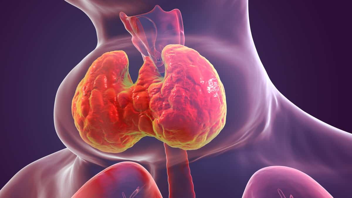 Povišen tsh - uzrok, simptomi, liječenje - Arz.hr